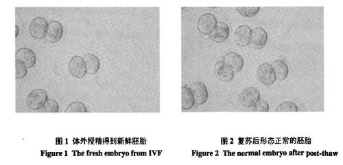 液氮運(yùn)輸罐短期儲存胚胎的可行性研究的結(jié)果